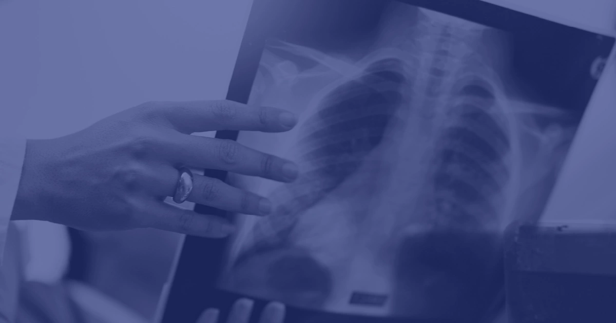 onsite mobile xray testing unit